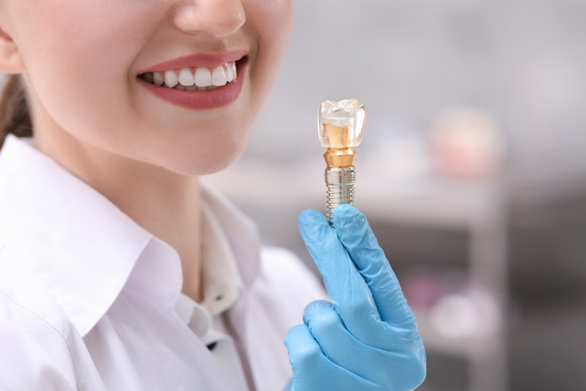 everything you need to know about dental implants: types and more